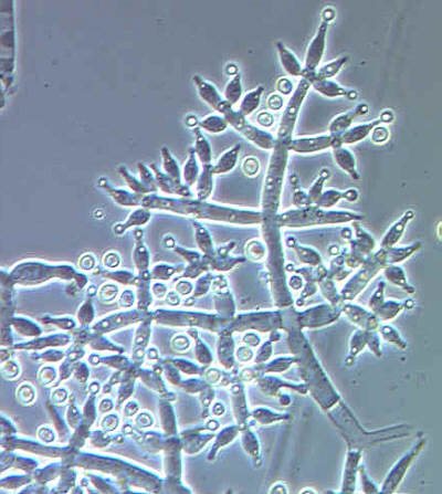 Trichoderma al microscopio: estructuras que producen esporas